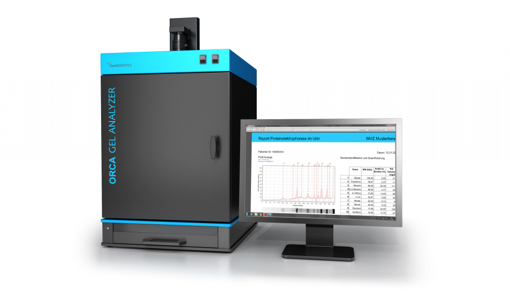 ORCA Gel Analyzer