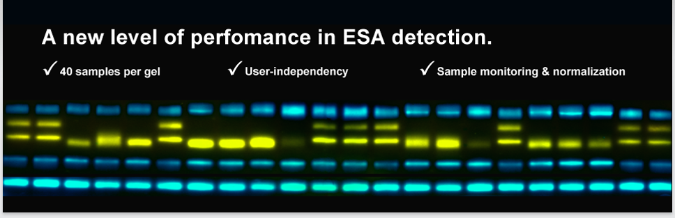 Header EPO Doping Protein Analysis