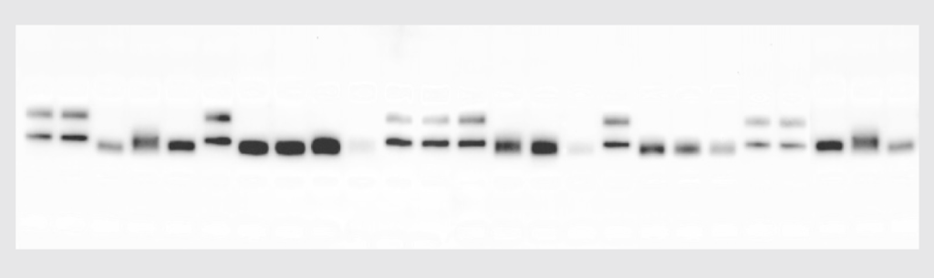 Image of Velum Gold 1D Gel/ Western Blot EPO detection by Octoplus QPLEX using chemoluminescence